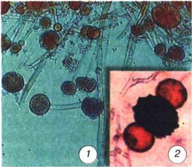 Мукор: 1. міцелій з спорангіями; 2 - формування зиготи