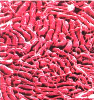 Колонії хвороботворної бактерії гелікобактер в кишечнику людини